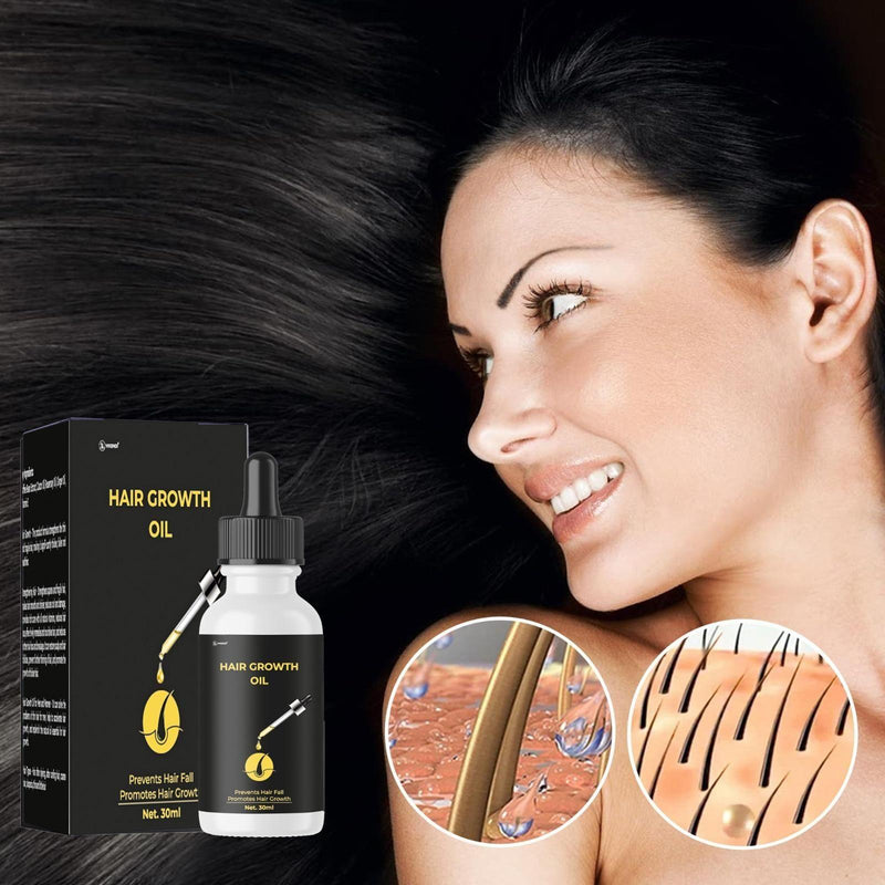 Hair Growth Oil Prevent Hair Fall Promotes Hair Growth 30ML -  Store_name 