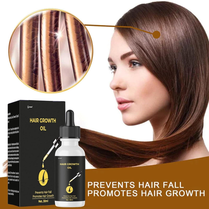 Hair Growth Oil Prevent Hair Fall Promotes Hair Growth 30ML -  Store_name 