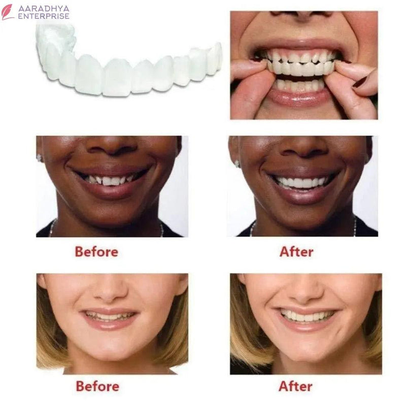 Instant and Confident on Smile Fit Flex Cosmetic Teeth Denture Teeth -  Store_name 